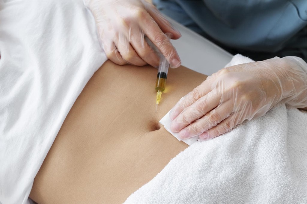 MESOTERAPIA