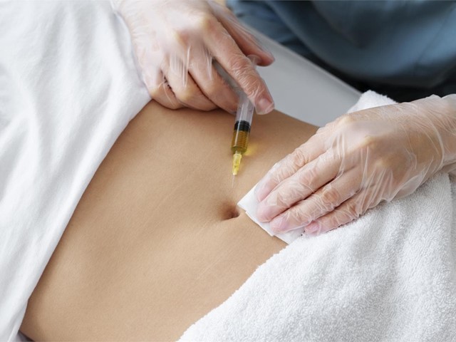 MESOTERAPIA